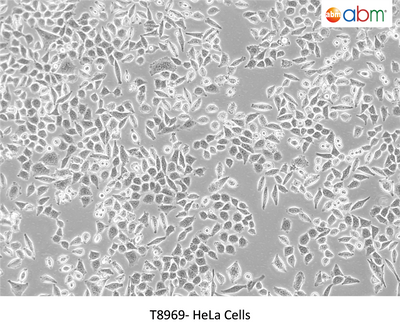 HeLa Cells – Figure 1 of 1