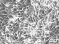 RenCa cell