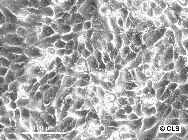 RenCa cell