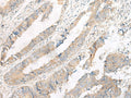 FERD3L Polyclonal Antibody – Figure 1 of 3
