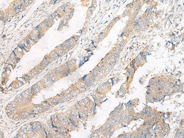 FERD3L Polyclonal Antibody – Figure 1 of 3