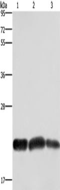 CBX3 Polyclonal Antibody – Figure 1 of 4