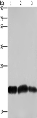 CBX3 Polyclonal Antibody – Figure 1 of 4