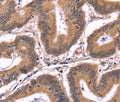 CRK Polyclonal Antibody – Figure 1 of 2