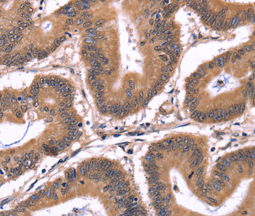 CRK Polyclonal Antibody – Figure 1 of 2