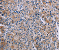 KDM4D Polyclonal Antibody – Figure 1 of 2