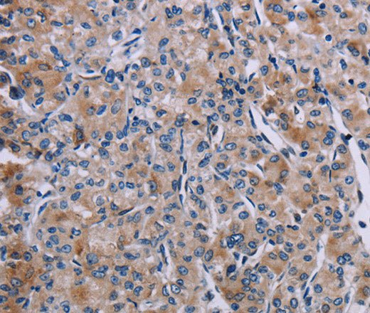 KDM4D Polyclonal Antibody – Figure 1 of 2
