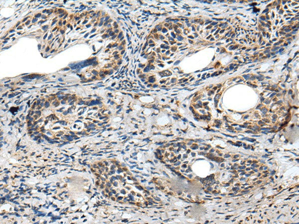 PRNP Polyclonal Antibody – Figure 1 of 3