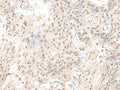 ILKAP Polyclonal Antibody – Figure 1 of 3
