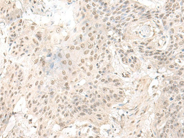 ILKAP Polyclonal Antibody – Figure 1 of 3