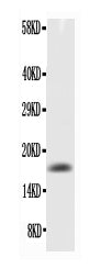 Anti-TNF alpha Antibody Picoband®