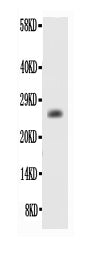 Anti-Bcl2 alpha Antibody Picoband®