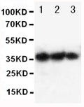 Anti-human EPO antibody, RP1004, Western blotting
Lane 1: Recombinant human EPO Protein 10ng 
Lane 2: Recombinant human EPO Protein 5ng 
Lane 3: Recombinant human EPO Protein 2