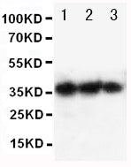 Anti-human EPO antibody, RP1004, Western blotting
Lane 1: Recombinant human EPO Protein 10ng 
Lane 2: Recombinant human EPO Protein 5ng 
Lane 3: Recombinant human EPO Protein 2