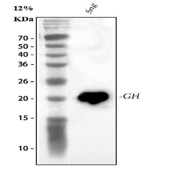 Anti-Growth Hormone/GH1 Antibody Picoband®