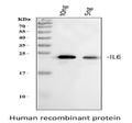Anti-Interleukin-6 IL6 Antibody Picoband®