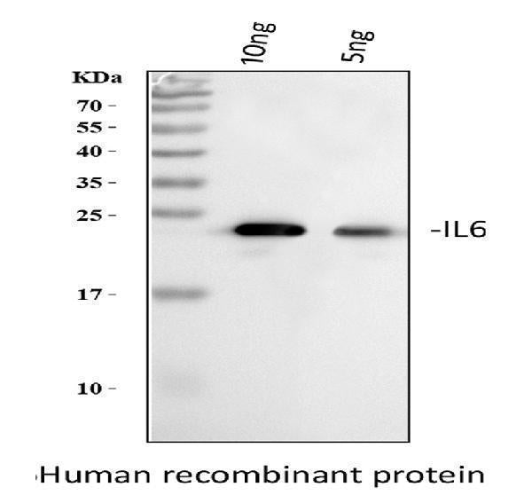 Anti-Interleukin-6 IL6 Antibody Picoband®