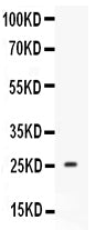 Western blot analysis of Prolactin expression in mouse testis extract (lane 1). Prolactin at 26KD was detected using rabbit anti-Prolactin Antigen Affinity purified polyclonal antibody (Catalog # RP1021) at0.5 μg/mL. The blot was developed using chemiluminescence (ECL) method (Catalog # EK1002).