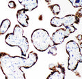 Anti-Growth Hormone/GH1 Antibody Picoband®