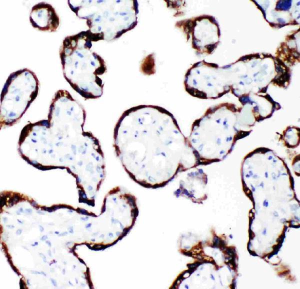 Anti-Growth Hormone/GH1 Antibody Picoband®