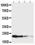 Anti-mouse Growth Hormone antibody, RP1024, Western blotting
Lane 1: Recombinant Mouse GH Protein 10ng
Lane 2: Recombinant Mouse GH Protein 5ng
Lane 3: Recombinant Mouse GH Protein 2