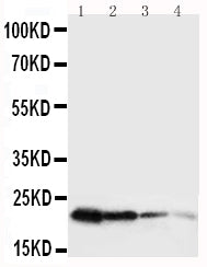 Anti-mouse Growth Hormone antibody, RP1024, Western blotting
Lane 1: Recombinant Mouse GH Protein 10ng
Lane 2: Recombinant Mouse GH Protein 5ng
Lane 3: Recombinant Mouse GH Protein 2