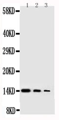 Anti-human NGF antibody, RP1025, Western blotting
Lane 1: Recombinant Human NGFB Protein 10ng
Lane 2: Recombinant Human NGFB Protein 5ng
Lane 3: Recombinant Human NGFB Protein 2