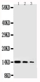 Anti-human NGF antibody, RP1025, Western blotting
Lane 1: Recombinant Human NGFB Protein 10ng
Lane 2: Recombinant Human NGFB Protein 5ng
Lane 3: Recombinant Human NGFB Protein 2