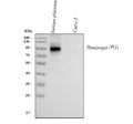 Anti-Angiostatin K1-3/PLG Antibody Picoband®