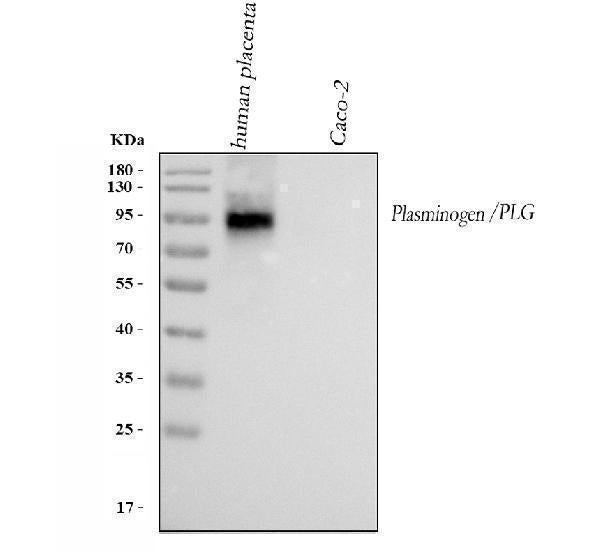 Anti-Angiostatin K1-3/PLG Antibody Picoband®