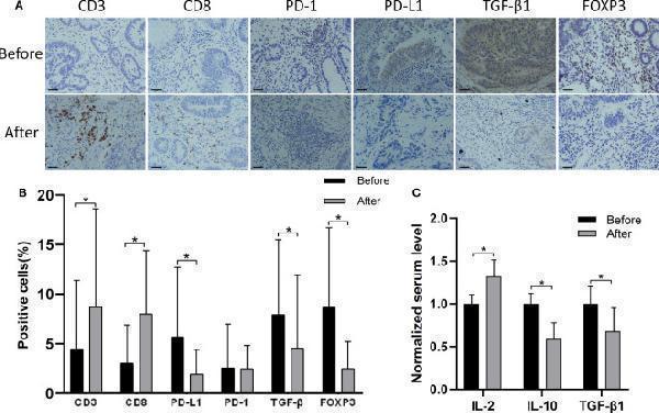 Anti-Forkhead box protein P3 FOXP3 Antibody