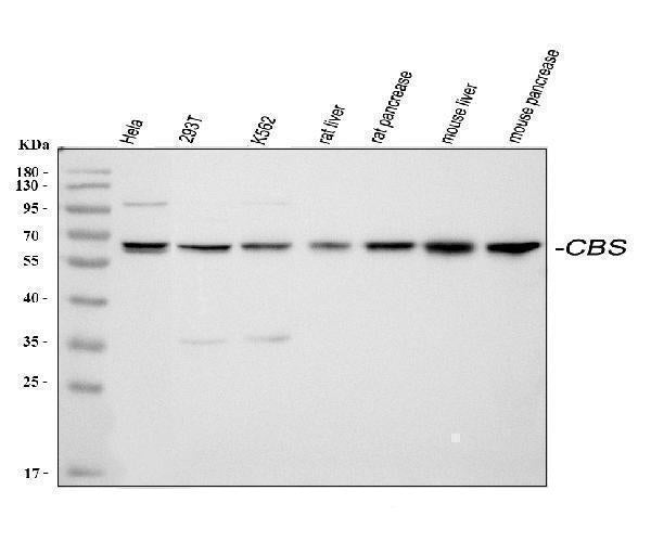 Anti-Cystathionine beta-synthase CBS Antibody Picoband®