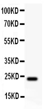 Anti-Claudin 5 Picoband antibody, RP1043, Western blotting
All lanes: Anti Claudin-5 (RP1043) at 0.5ug/ml
WB: Rat Liver Tissue Lysate at 50ug
Predicted bind size: 23KD
Observed bind size: 23KD