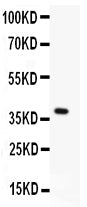 Anti-MBD2 antibody, RP1049, Western blotting
All lanes: Anti MBD2 (RP1049) at 0.5ug/m
lWB: Recombinant Human MBD2 Protein 0.5ng
Predicted bind size: 40KD
Observed bind size: 40KD