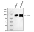 Anti-SERCA2 ATPase/ATP2A2 Antibody Picoband®