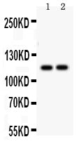 Anti-SERCA3 ATPase/ATP2A3 Antibody Picoband®