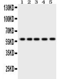 Anti-Occludin antibody, RP1057, Western blotting
All lanes: Anti Occludin (RP1057) at 0.5ug/ml
Lane 1: SW620 Whole Cell Lysate at 40ug
Lane 2: COLO320 Whole Cell Lysate at 40ug
Lane 3: A549 Whole Cell Lysate at 40ug
Lane 4: 293T Whole Cell Lysate at 40ug
Lane 5: U87 Whole Cell Lysate at 40ug
Predicted bind size: 59KD
Observed bind size: 59KD