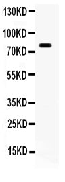 Anti-FE65 antibody, RP1059, Western blotting
All lanes: Anti (RP1059) at 0.5ug/ml
WB: Mouse Brain Tissue Lysate at 50ug
Predicted bind size: 77KD
Observed bind size: 77KD