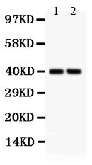 Anti-SFRP4 Picoband antibody, RP1067, Western blotting
All lanes: Anti SFRP4 (RP1067) at 0.5ug/ml
Lane 1: Rat Cardiac Muscle Tissue Lysate at 50ug
Lane 2: SKOV Whole Cell Lysate at 40ug
Predicted bind size: 40KD
Observed bind size: 40KD