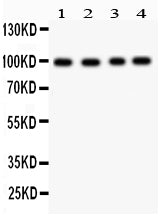 Anti-Synaptopodin antibody, RP1069, Western blotting
All lanes: Anti Synaptopodin (RP1069) at 0.5ug/ml
Lane 1: Mosue Brain Tissue Lysate at 50ug
Lane 2: U87 Whole Cell Lysate at 40ug
Lane 3: HEPG2 Whole Cell Lysate at 40ug
Lane 4: 293T Whole Cell Lysate at 40ug
Predicted bind size: 99KD
Observed bind size: 99KD