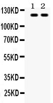 Anti-TLR8 antibody, RP1073, Western blotting
All lanes: Anti TLR8 (RP1073) at 0.5ug/ml
Lane 1: Rat Liver Tissue Lysate at 50ug
Lane 2: HEPG2 Whole Cell Lysate at 40ug
Predicted bind size: 120KD
Observed bind size: 120KD