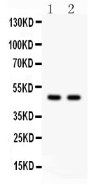 Anti-PTOV1 antibody, RP1087, Western blotting
All lanes: Anti PTOV1 (RP1087) at 0.5ug/ml

Lane 1: Rat Brain Tissue Lysate at 50ug

Lane 2: Rat Kidney Tissue Lysate at 50ug

Predicted bind size: 47KD

Observed bind size: 47KD