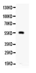 Anti-RP1089 antibody, PBMMP12, Western blotting
All lanes: Anti MMP12 (RP1089) at 0.5ug/ml
WB: HEPA Whole Cell Lysate at 40ug
Predicted bind size: 55KD
Observed bind size: 55KD