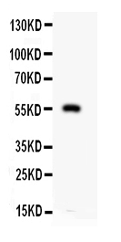 Anti-RP1089 antibody, PBMMP12, Western blotting
All lanes: Anti MMP12 (RP1089) at 0.5ug/ml
WB: HEPA Whole Cell Lysate at 40ug
Predicted bind size: 55KD
Observed bind size: 55KD
