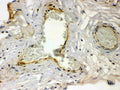 Anti-Thrombin Receptor  antibody, RP1092, IHC(P)
IHC(P): Human Placenta Tissue
