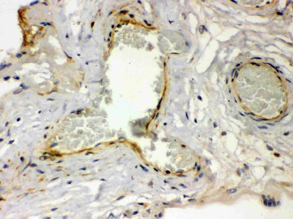 Anti-Thrombin Receptor  antibody, RP1092, IHC(P)
IHC(P): Human Placenta Tissue