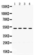 Anti-TIM1 antibody, RP1093, Western blotting
All lanes: Anti TIM1 (RP1093) at 0.5ug/ml

Lane 1: HELA Whole Cell Lysate at 40ug

Lane 2: PANC Whole Cell Lysate at 40ug

Lane 3: HEPG2 Whole Cell Lysate at 40ug

Lane 4: A549 Whole Cell Lysate at 40ug

Predicted bind size: 39KD

Observed bind size: 49KD