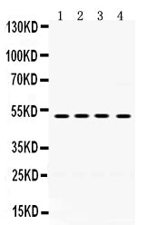 Anti-TIM1 antibody, RP1093, Western blotting
All lanes: Anti TIM1 (RP1093) at 0.5ug/ml

Lane 1: HELA Whole Cell Lysate at 40ug

Lane 2: PANC Whole Cell Lysate at 40ug

Lane 3: HEPG2 Whole Cell Lysate at 40ug

Lane 4: A549 Whole Cell Lysate at 40ug

Predicted bind size: 39KD

Observed bind size: 49KD