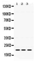 Anti-GTPase HRAS  antibody, RP1098, Western blotting
All lanes: Anti GTPase HRAS (RP1098) at 0.5ug/ml

Lane 1: Mouse Brain Tissue Lysate at 50ug

Lane 2: HELA Whole Cell Lysate at 40ug

Lane 3: A549 Whole Cell Lysate at 40ug

Predicted bind size: 21KD

Observed bind size: 21KD