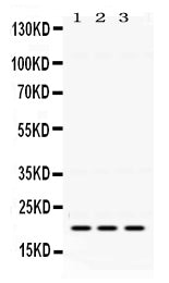 Anti-GTPase HRAS  antibody, RP1098, Western blotting
All lanes: Anti GTPase HRAS (RP1098) at 0.5ug/ml

Lane 1: Mouse Brain Tissue Lysate at 50ug

Lane 2: HELA Whole Cell Lysate at 40ug

Lane 3: A549 Whole Cell Lysate at 40ug

Predicted bind size: 21KD

Observed bind size: 21KD